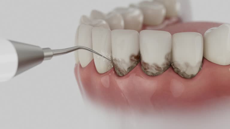 Trusted Emergency Dentist service in Dunkirk, MD - Dentist Open Now